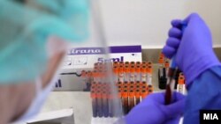 Коронавирус тарқалиши бўйича АҚШ ҳамон етакчилик қилмоқда.