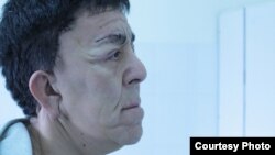 Нуржан Уркешбаев после пластической операции. Фото предоставлено алматинской клиникой «Ниссамед».